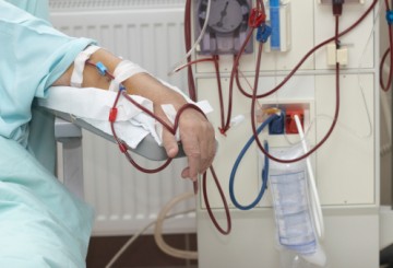 COVID-19’s burden on those living with kidney failure