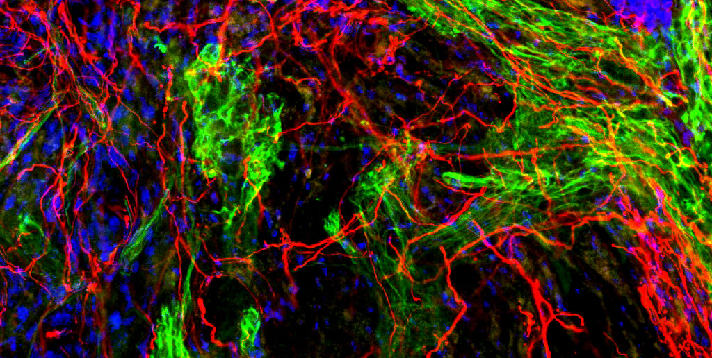 Regenerated axons (red) and glial cells (green) in the center of the lesion.