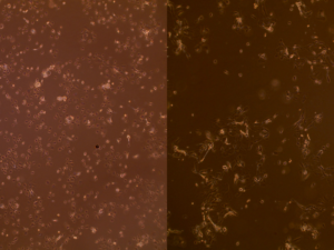 Airway epithelial cells from children between 2-3 years of age. Left is control, right is after RSV infection. 