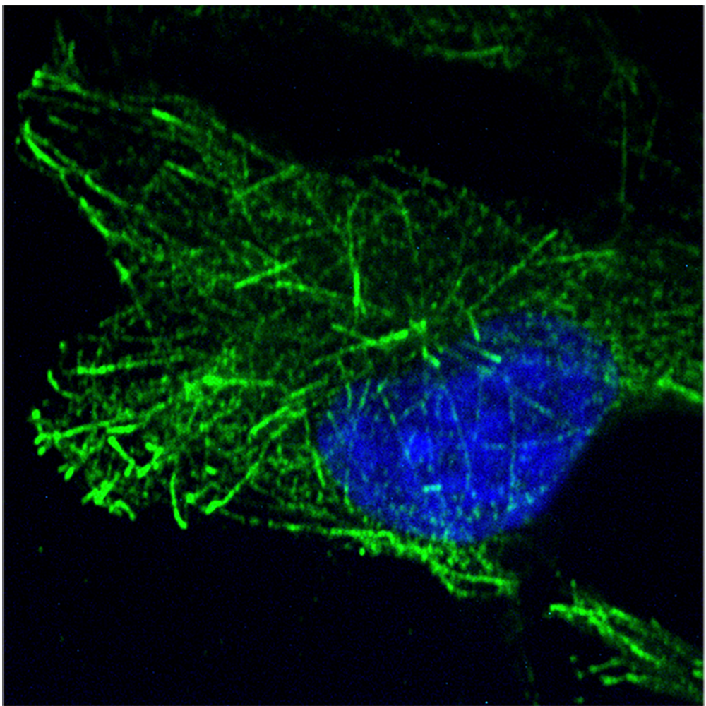 Investigating Mechanisms Behind Early HIV-1 Infection