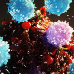 Tumors Dramatically Shrink With New Approach to Cell Therapy