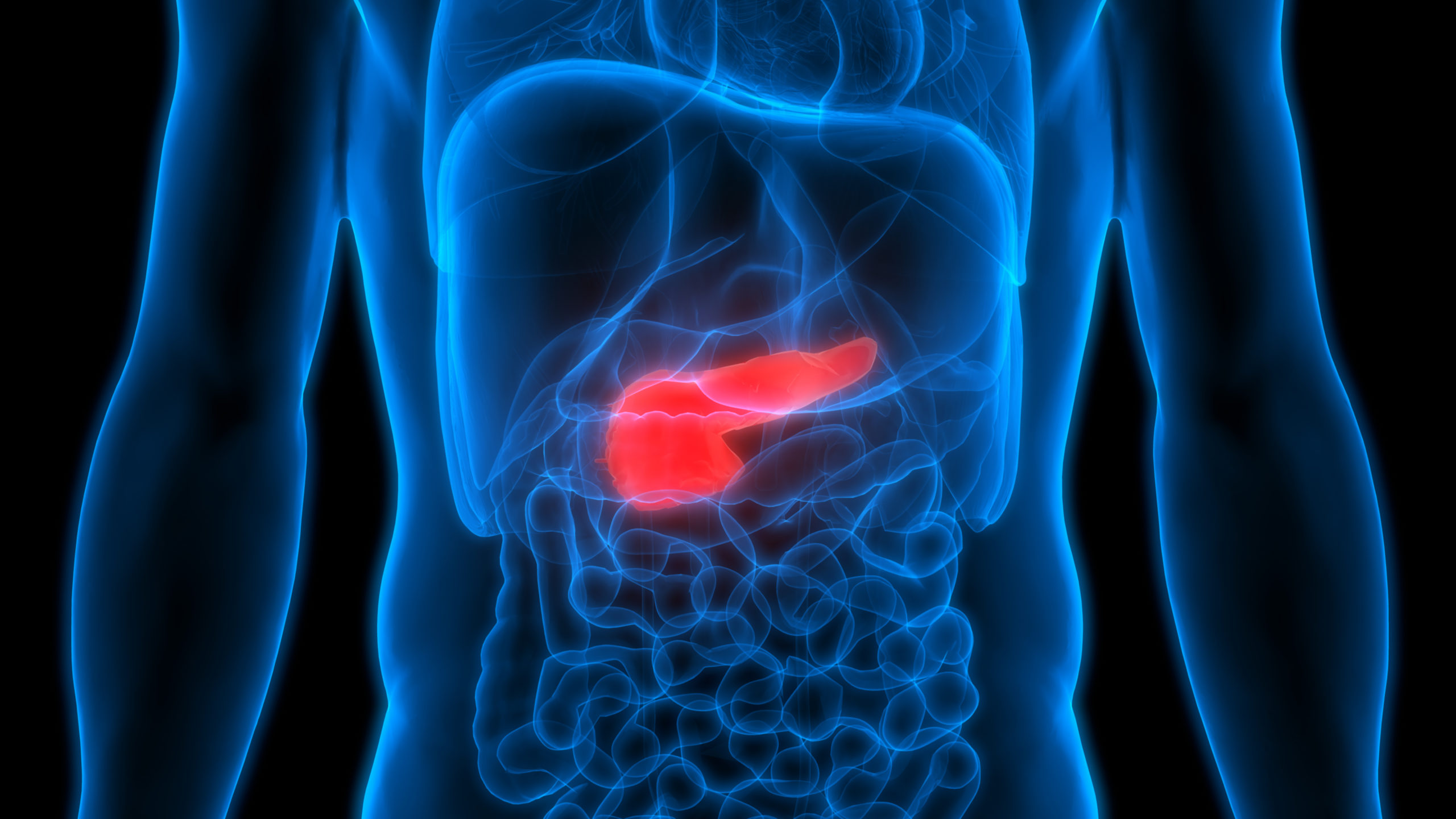 Investigators Identify Potential Therapeutic Target for Pancreatic Cancer