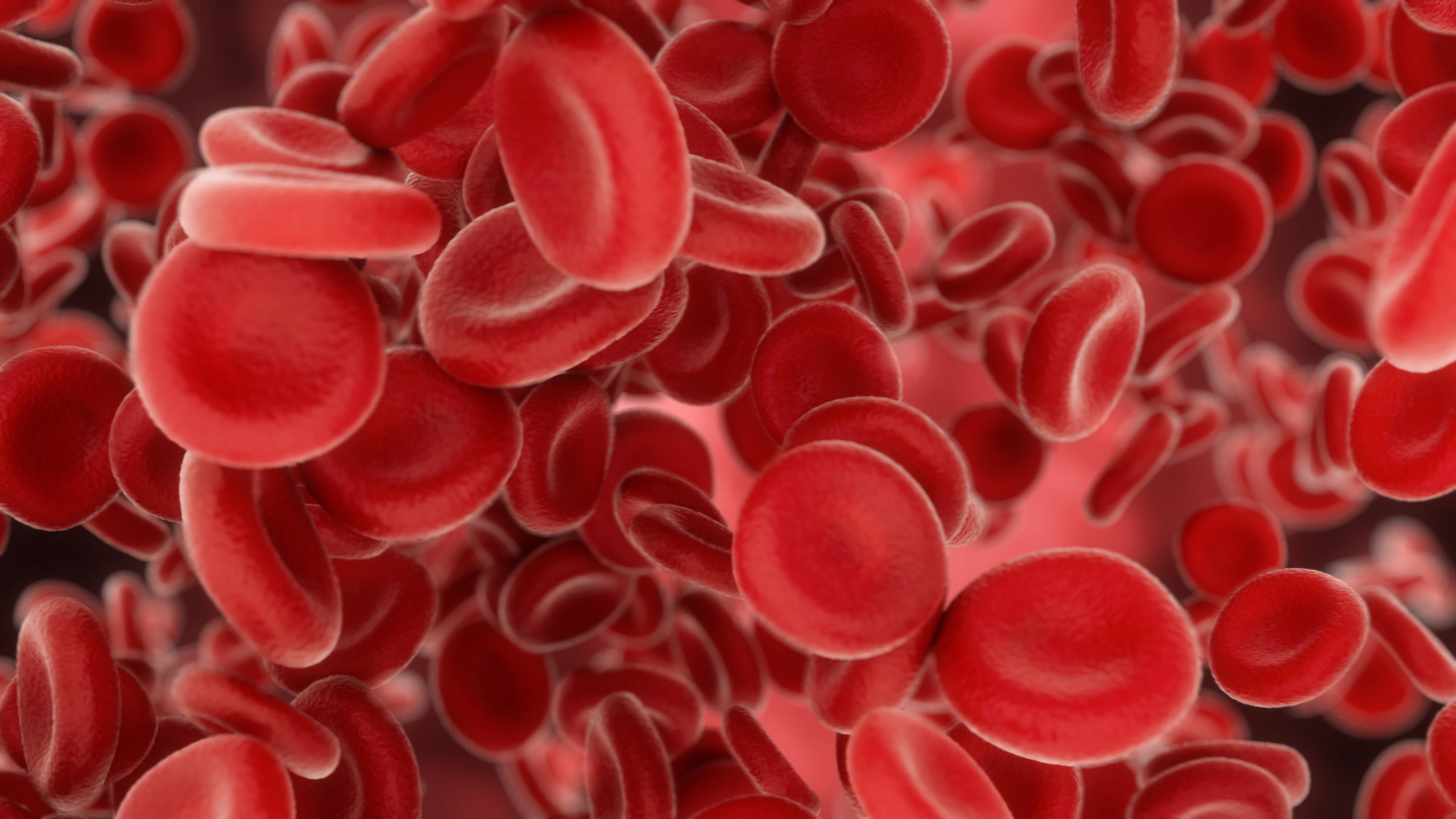 Gene Therapy Promotes Transfusion Independence for Severe Beta-Thalassemia