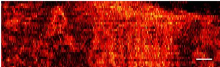 New Technique Improves Proteoform Imaging in Human Tissue