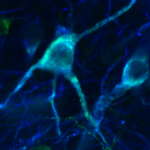 Study Uncovers Role of Mitochondrial Energy Production in Dopaminergic Neurons