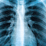 Artificial Intelligence and Medicine with Mozziyar Etemadi, MD, PhD