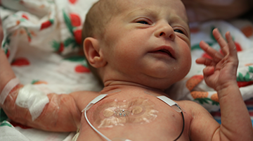 Wireless Technology in the NICU with John A. Rogers, PhD, and Amy Paller, MD