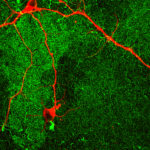 Mature ‘Lab Grown’ Neurons Hold Promise for Neurodegenerative Disease