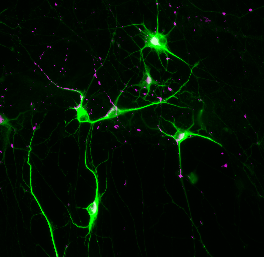 Potential Therapeutic Target for Schizophrenia Identified 