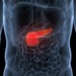 Combination Treatment Extends Progression-Free Survival in Pancreatic Cancers  