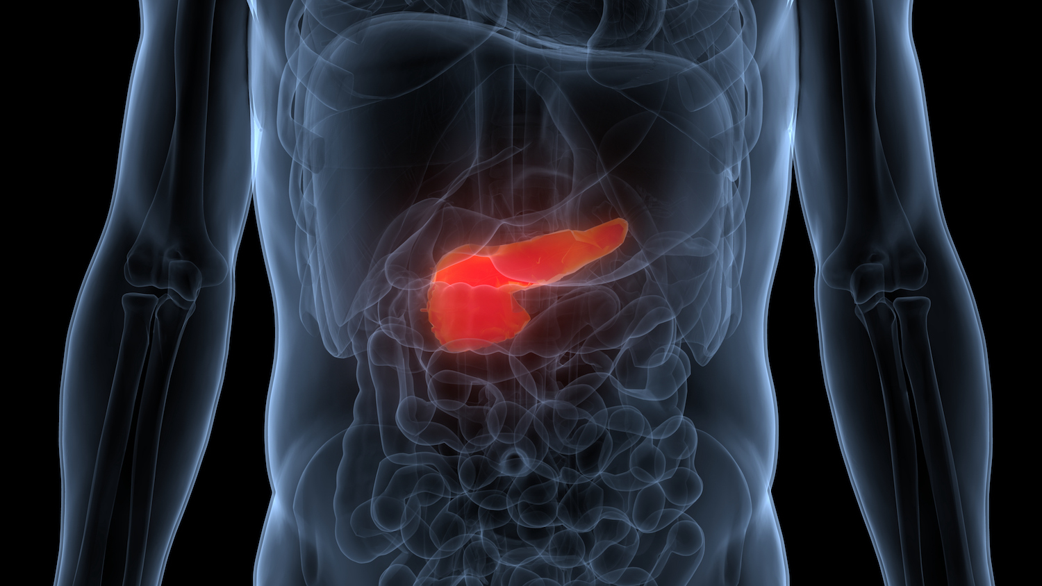 Combination Treatment Extends Progression-Free Survival in Pancreatic Cancers  