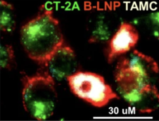 Developing New Nanoparticle Treatments for Brain Tumors