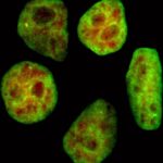Investigating the Link Between Iron Deficiency and Regulation of Cell Growth