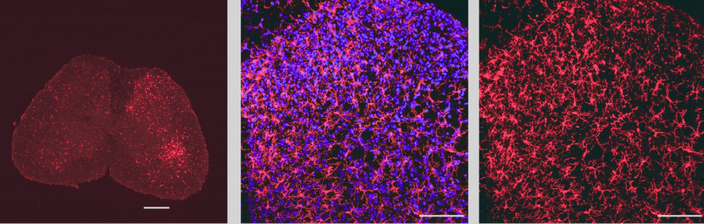 Image showing microglia in the lumbar spinal cord labeled with the microglial marker IBA1 (in red). The blue stain shows nuclei of cells labeled with a nuclear marker.