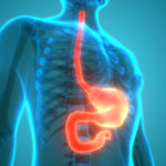 Combination Therapy Improves Quality of Life in Advanced Stomach Cancer, Esophageal Cancer  