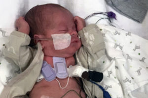 Wearable devices capture sounds inside a premature baby's lungs. Credit: Montreal Children's Hospital