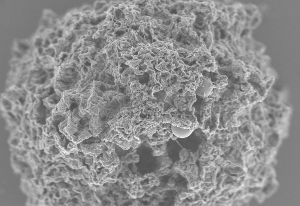 A scanning electron microscope image of the nanoparticle (small sphere in center) inside a mast cell.