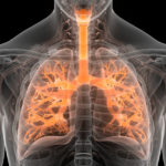 Potential Therapeutic Target for Small Cell Lung Cancer Discovered
