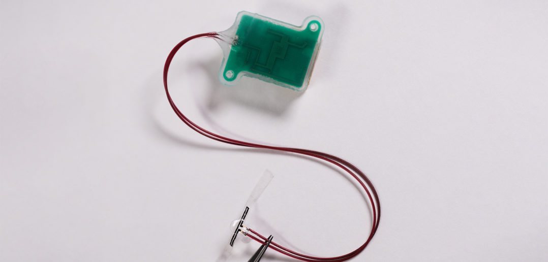 A new soft, flexible, battery-free implant that attaches to the bladder wall to sense filling. The elongated tab (near the tip of the tweezers) is the soft, stretchable sensor. The green box is the implantable "base station," which holds the electrical components to power the device and wirelessly transmit data.