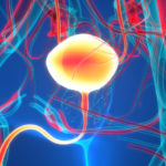 Combination Therapy May Improve Outcomes for Advanced Bladder Cancer