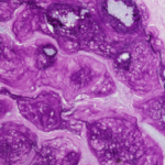 Advancing Skin Cell Biology with Kathleen Green, PhD