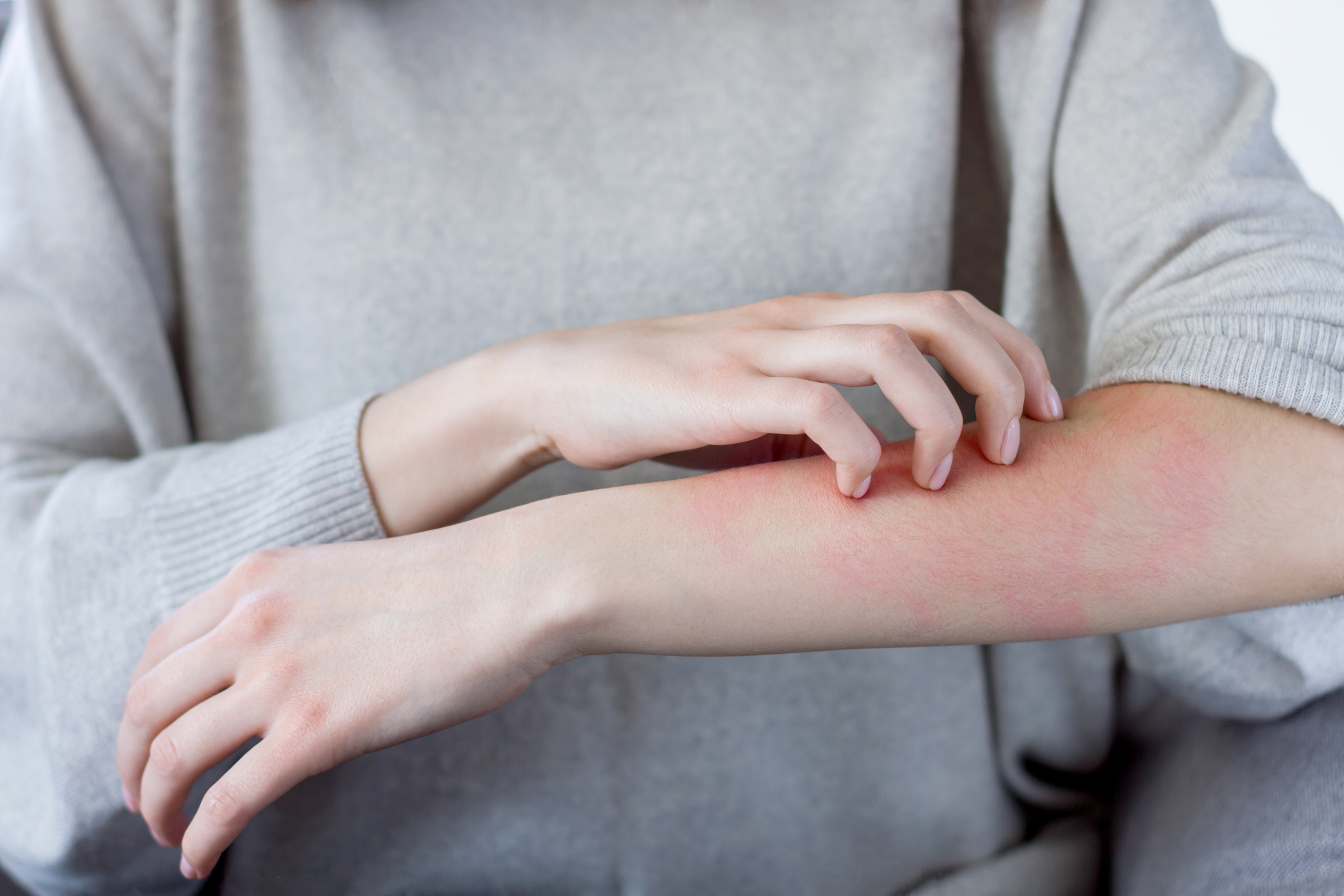 Improving Atopic Dermatitis Treatment for Adolescents