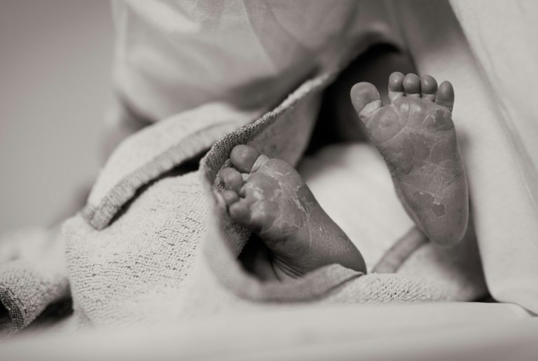 Preventing Lung Disease in Preterm Babies 