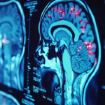 New Insights from Inside the Brain with Rodrigo Braga, PhD
