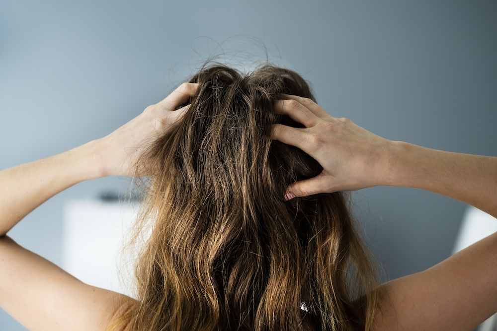 How Hair Follicles Sense Their Environment