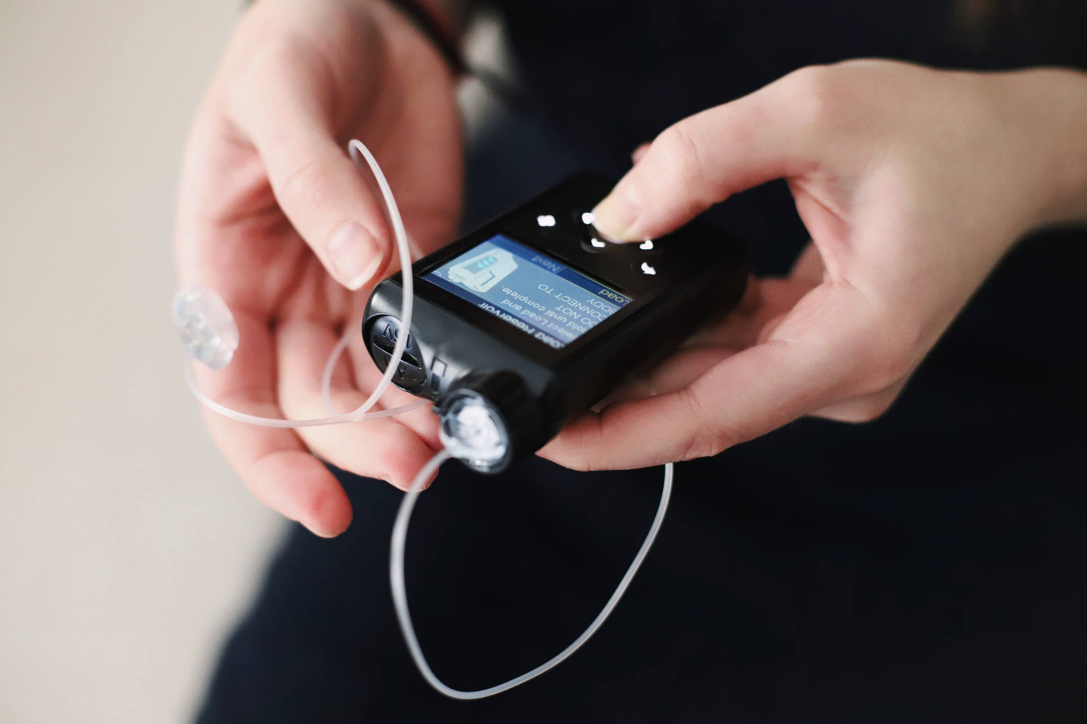 Insulin Pump Improves Glucose Levels in Patients with Type 2 Diabetes