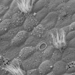 Novel Mechanism Reduces Epithelial Cell Damage and Loss
