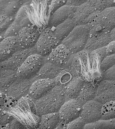 Novel Mechanism Reduces Epithelial Cell Damage and Loss