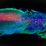 ‘Dancing Molecules’ Treatment Receives FDA Orphan Drug Designation