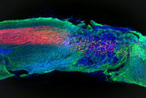 A longitudinal spinal cord section treated with the most bioactive therapeutic scaffold. Regenerated axons (shown in red) regrew within the lesion. To administer the treatment, researchers inject the liquid therapy into the region where a spinal cord injury occurred. The liquid then gels into a network of nanofibers, which serve as a scaffold to support cell growth.