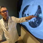 AI Matches Doctors in Mapping Lung Tumors for Radiation Therapy