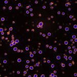 Cell Feature Implicated in Cancer Forms Differently than Previously Thought