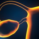 Transcription Factor Drives Chemotherapy Resistance in Ovarian Cancer