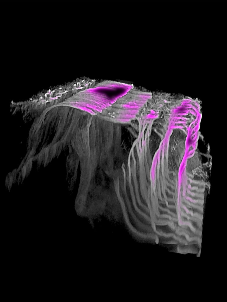 This image shows the cytoskeletons of various types of supporting cells, which are intercalated with the hair cells (not shown) and whose identity and precise alignment are dictated in part by the inner hair cells. Courtesy of the García-Añoveros laboratory.