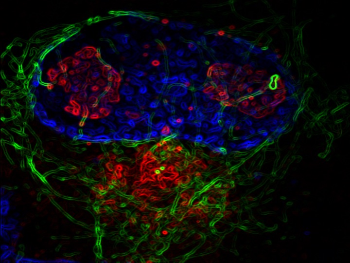 Common Virus ‘Rewires’ Intracellular Mechanisms to Promote Infection