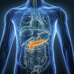 Common Procedure Does Not Prevent Recurrent Pancreatitis, Trial Finds 
