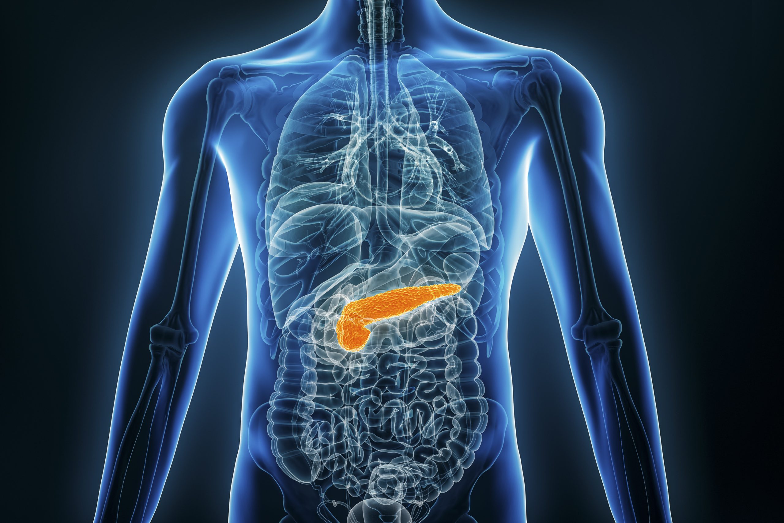 Common Procedure Does Not Prevent Recurrent Pancreatitis, Trial Finds 