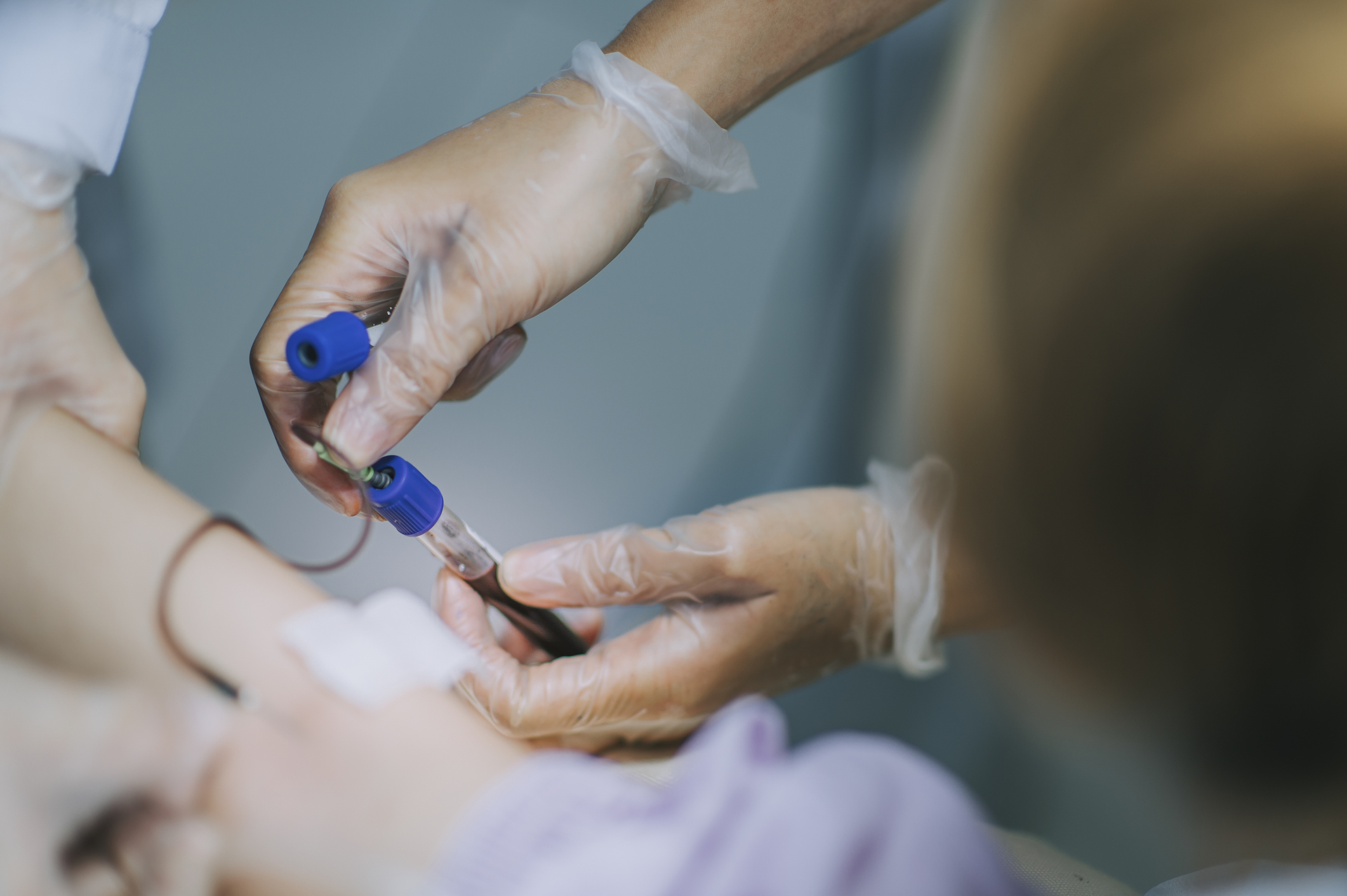 Study Finds Widespread Screening for Rare Cholesterol Disorder Not Cost-Effective