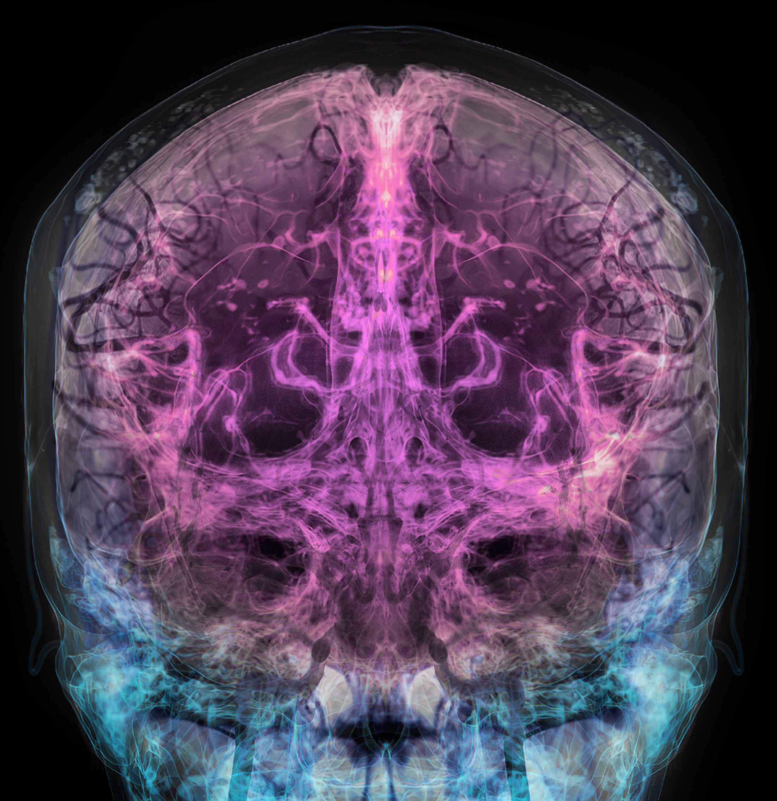 New Institute Envisions Future Where Our Brains Last as Long as Our Bodies