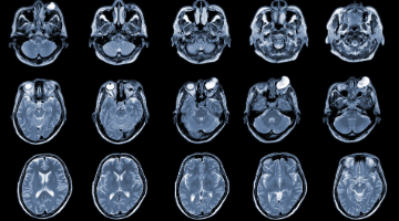 Improving Imaging of the Spinal Cord with Molly Bright, DPhil
