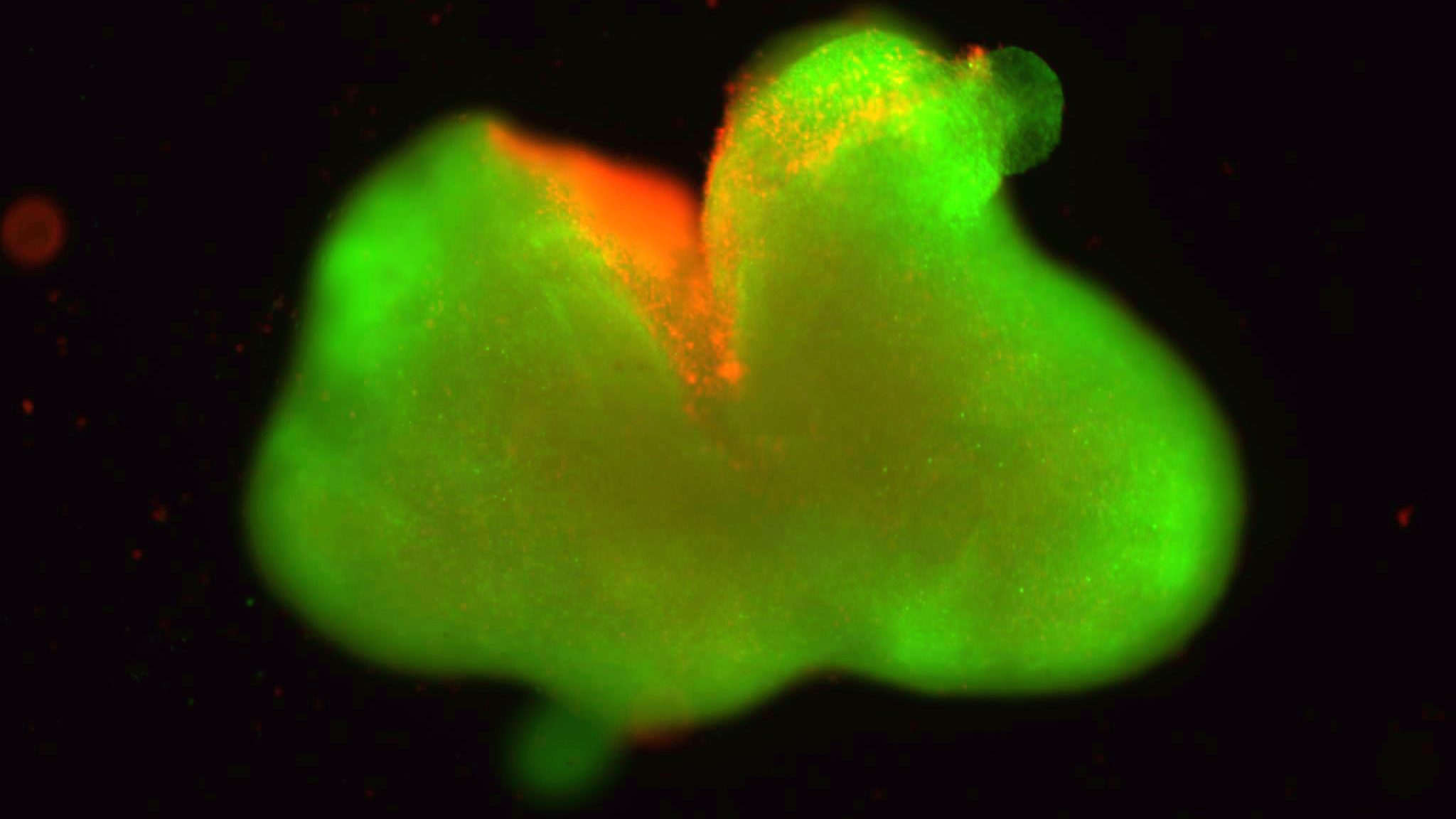 : A fluorescent image of the human spinal cord organoid laceration model. Dead cells are red and live cells are green. (Samuel I. Stupp/Northwestern University)