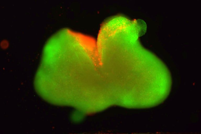 Paralysis Treatment Heals Lab-Grown Human Spinal Cord Organoids