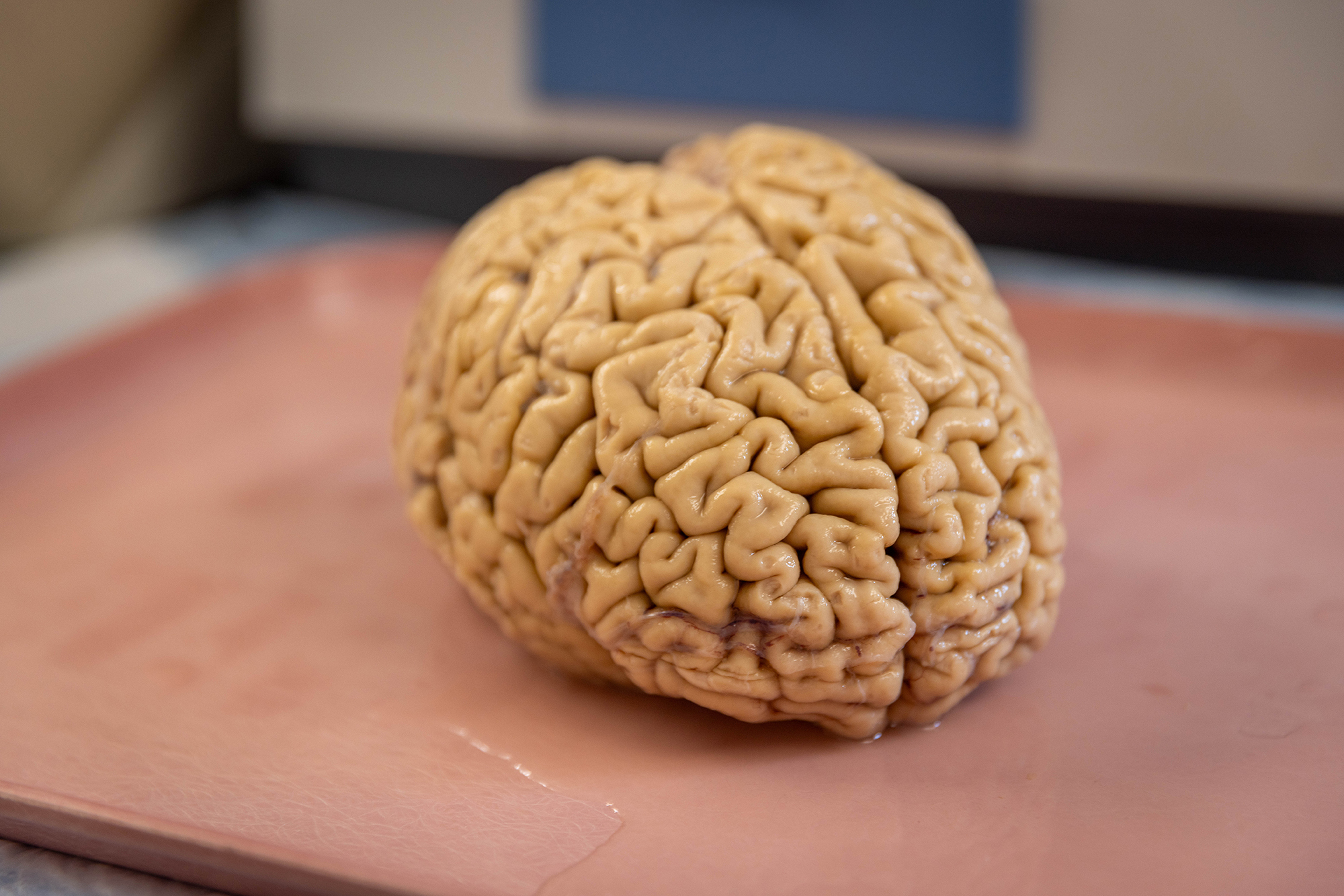 As Superagers Age, They Make at Least Twice as Many New Neurons as Their Peers