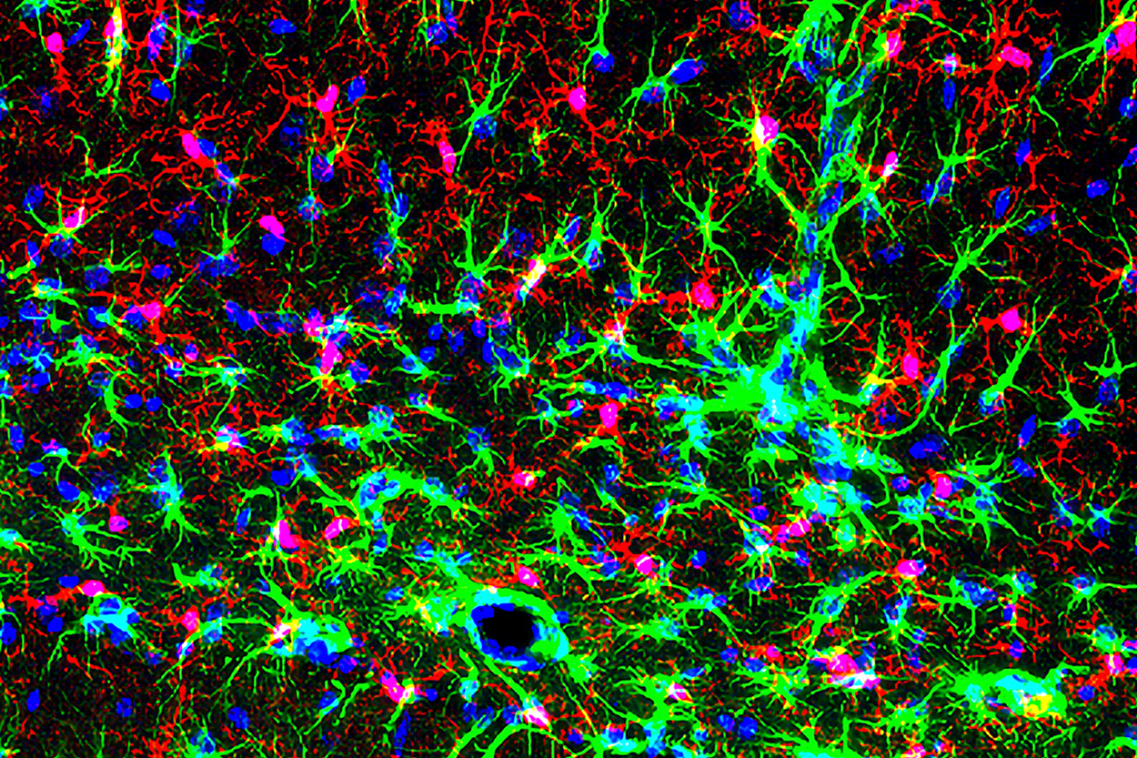 Calcium Signaling Channels Regulate Neuroinflammation and Motivation
