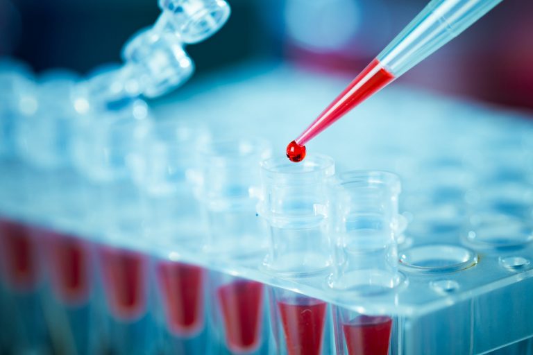 First Gene Regulation Clinical Trials for Epilepsy Show Promising Results