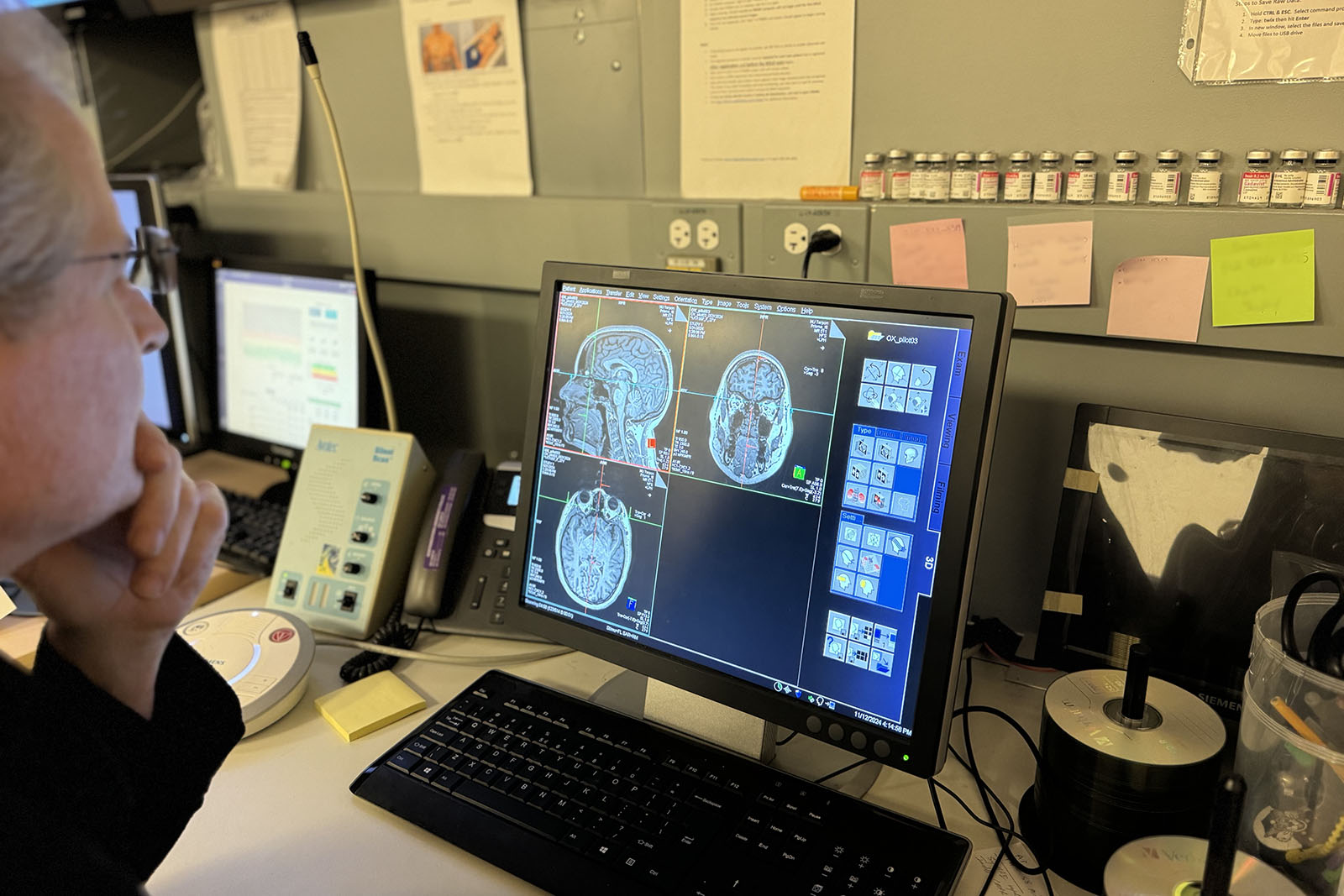 Imagination is More Than Sensory Replay